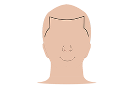 SMP Fashion Hairline